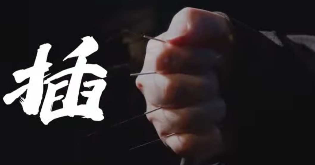 AI와 한의학: 침술에 AI를 쓴다고?